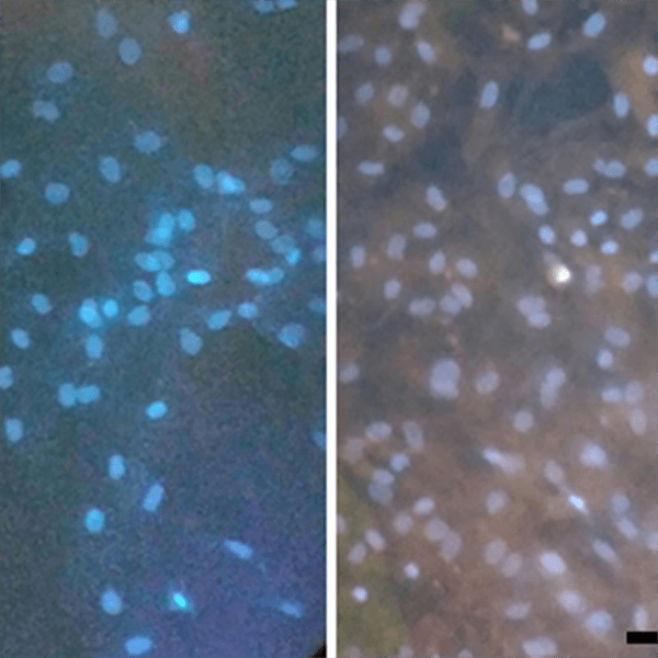Stained Keratinocytes