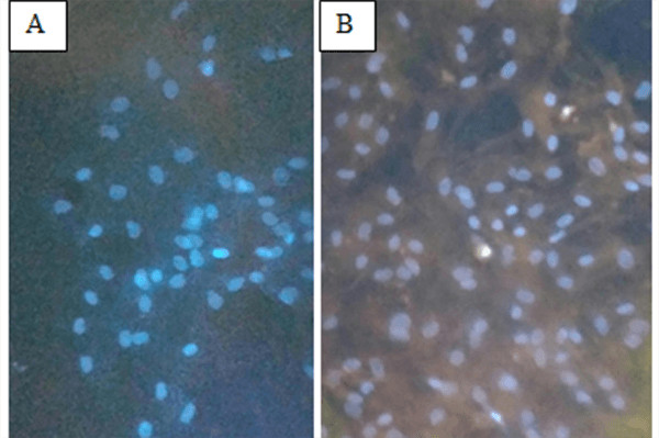 Cells before and after Keratinocyte differentiation stained.