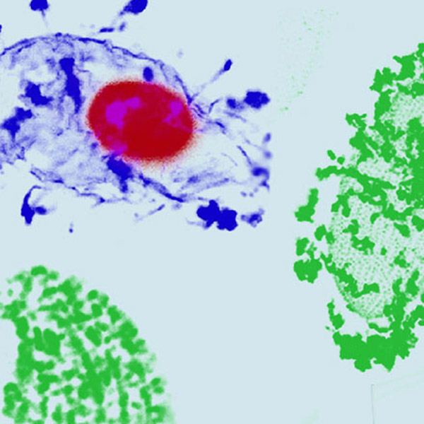 Stained Tetrahymena